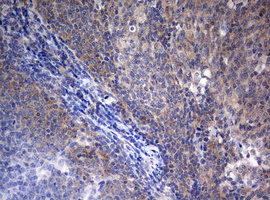 m00217 2 anti lkb1 stk11 mouse monoclonal antibody clone id oti0a3 ihc testing 7