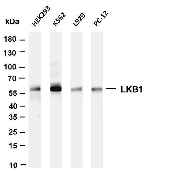 Various whole cell lysates were separated by 4-20% SDS-PAGE, and the membrane was blotted with anti-LKB1 antibody