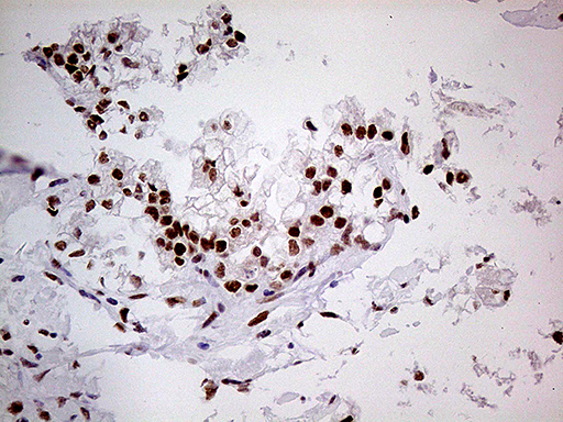 m00219 1 anti fto mouse monoclonal antibody clone id oti4a1 ihc testing 3