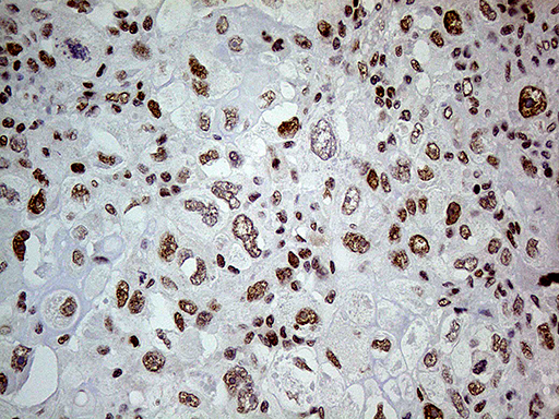 m00219 1 anti fto mouse monoclonal antibody clone id oti4a1 ihc testing 9