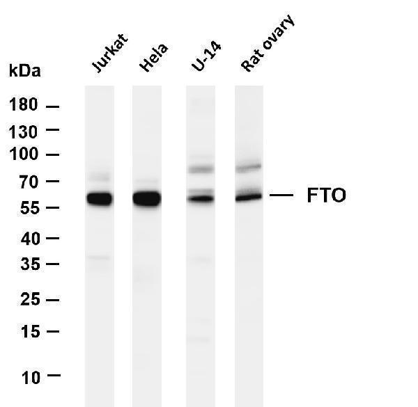 Various whole cell lysates were separated by 4-20% SDS-PAGE, and the membrane was blotted with anti- FTO antibody