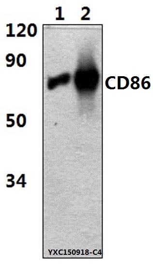 Western blot (WB) analysis of CD86(7H3) mAb at 1:2000 dillution
Lane1:The Spleen tissue lysate of Rat(15μg)
Lane2:The Spleen tissue lysate of Mouse(15μg)