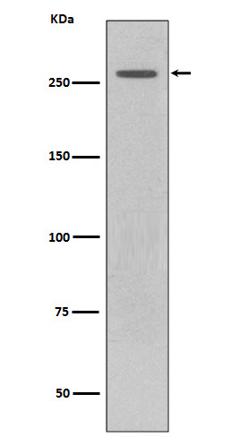 Western blot analysis of LRRK2 expression in GFP-LRRK2 lysate