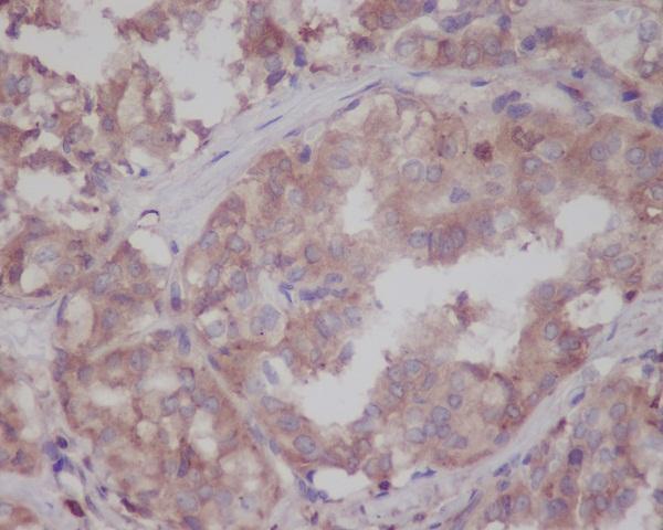 Immunohistochemical analysis of paraffin-embedded human thyroid, using LRRK2  Antibody