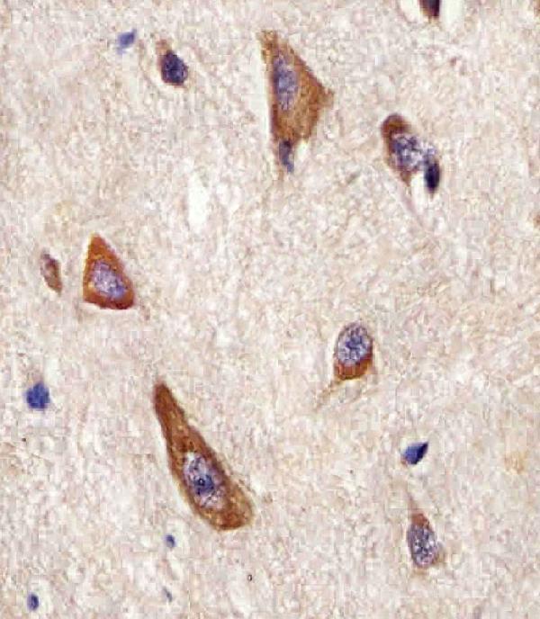 M00221-3 staining LRRK2 in Human brain tissue sections by Immunohistochemistry (IHC-P -paraformaldehyde-fixed, paraffin-embedded sections)