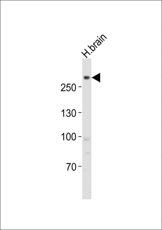 Anti-LRRK2 Antibody (C-term) at 1:1000 dilution + human brain lysatesLysates/proteins at 20 µg per lane