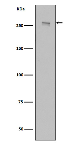 Western blot analysis of LRRK2 in HEK293 cell lysate transfected with 3*Flag wild type, full length LRRK2