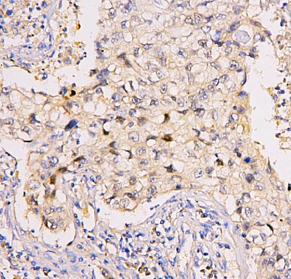  IHC analysis of BRG1 using anti-BRG1 antibody (M00223-1)