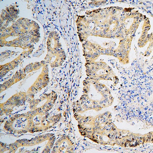  IHC analysis of BRG1 using anti-BRG1 antibody (M00223-1)