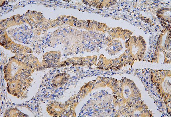 m00223 1 brg1 primary antibodies ihc testing 4