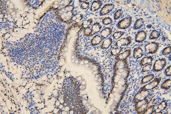 m00223 1 brg1 primary antibodies ihc testing 5