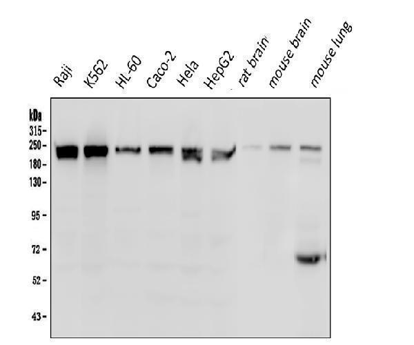  Western blot analysis of BRG1 using anti-BRG1 antibody (M00223-1)