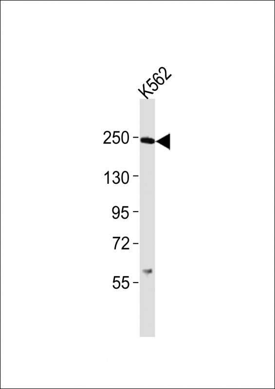 Anti-Smarca4 Antibody (C-term)at 1:2000 dilution + K562 whole cell lysatesLysates/proteins at 20 µg per lane