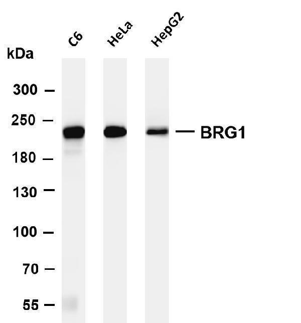Various whole cell lysates were separated by 4-8% SDS-PAGE, and the membrane was blotted with anti-BRG1 antibody