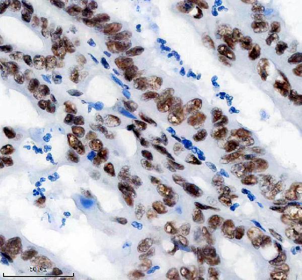 IHC analysis of SMARCA4/BRG1 using anti-SMARCA4/BRG1 antibody (M00223)