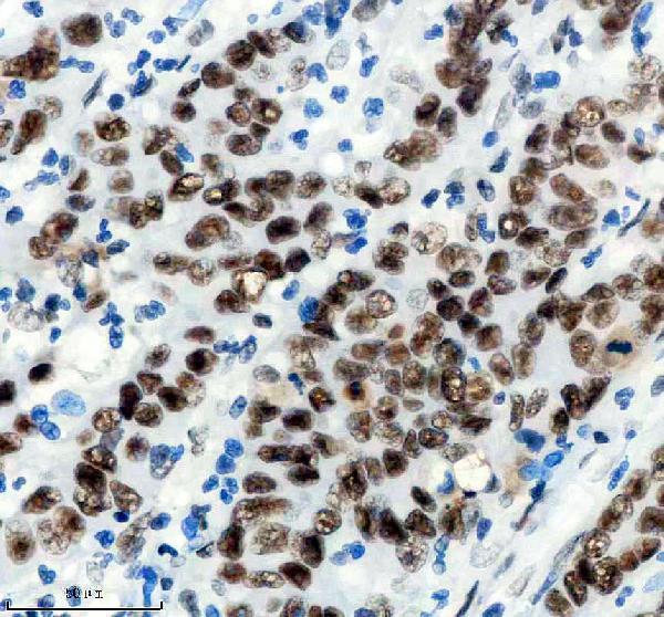 m00223 smarca4 primary antibodies ihc testing 2
