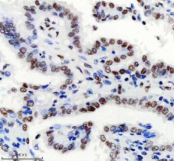 m00223 smarca4 primary antibodies ihc testing 3