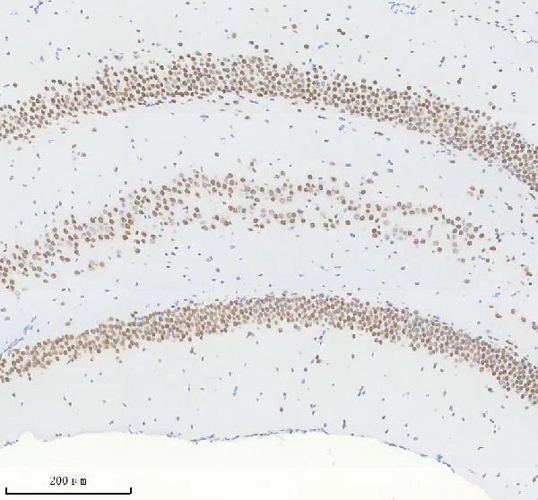 m00223 smarca4 primary antibodies ihc testing 4