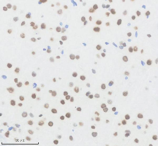 m00223 smarca4 primary antibodies ihc testing 5