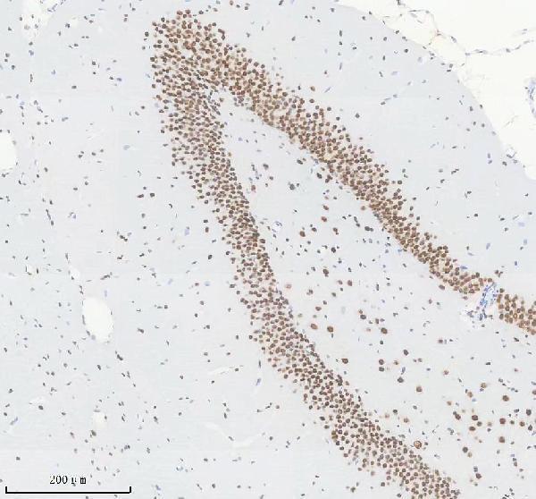 m00223 smarca4 primary antibodies ihc testing 6