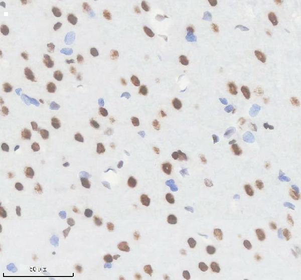 m00223 smarca4 primary antibodies ihc testing 7