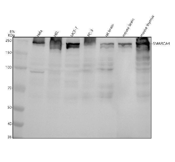Western blot analysis of SMARCA4/BRG1 using anti-SMARCA4/BRG1 antibody (M00223)