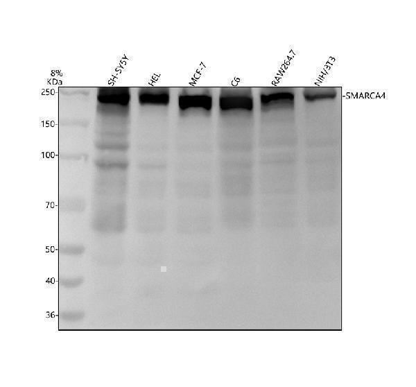 Western blot analysis of SMARCA4/BRG1 using anti-SMARCA4/BRG1 antibody (M00223)