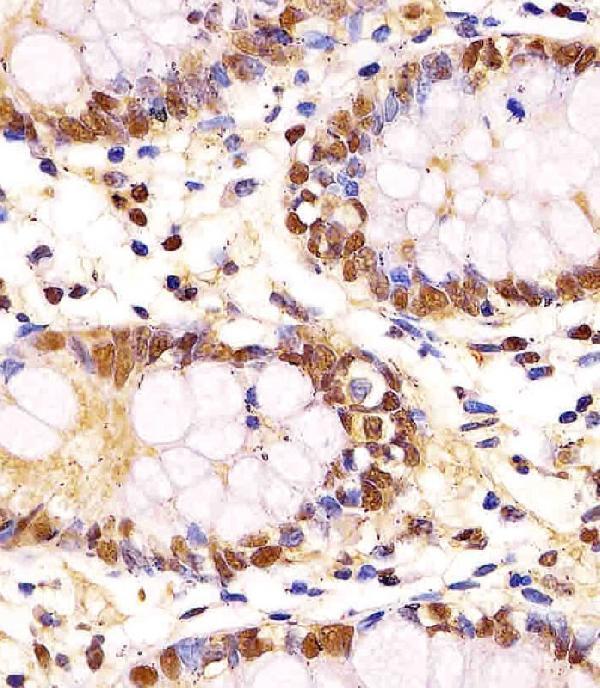 m00227 2 anti gapdh antibody ihc p testing 2
