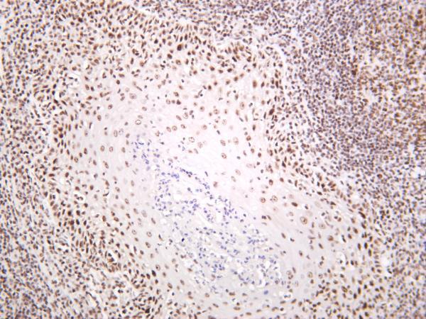 Human tonsil was stained with anti-Nucleolin rabbit antibody