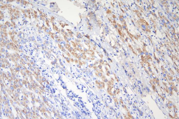 m00229 1 tuberin primary antibodies ihc testing 2