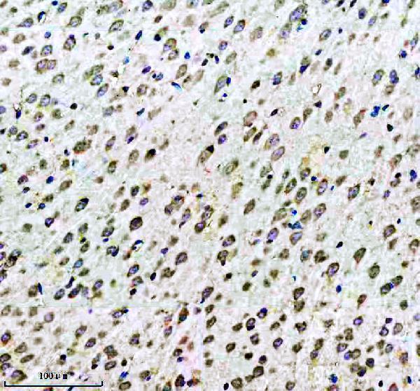 m00229s939 p tsc2 primary antibodies ihc testing 1