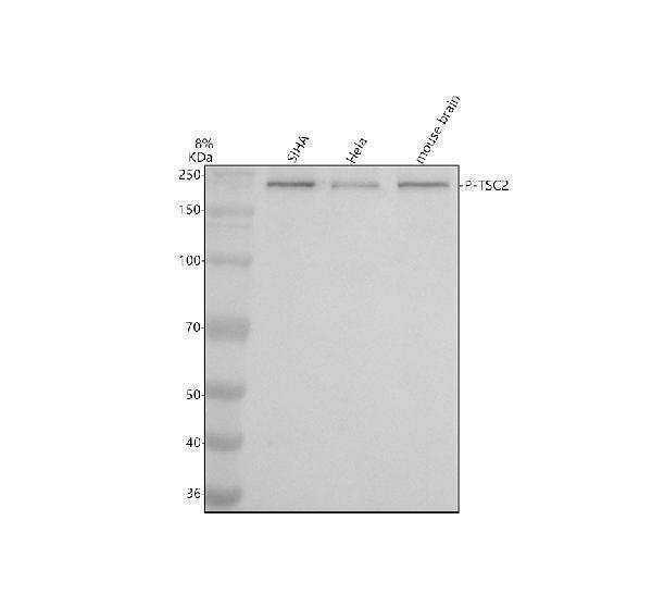 m00229s939 p tsc2 primary antibodies wb testing 2_1