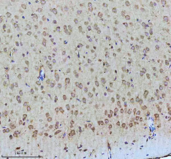 m00229s939 p tuberin primary antibodies ihc testing 2