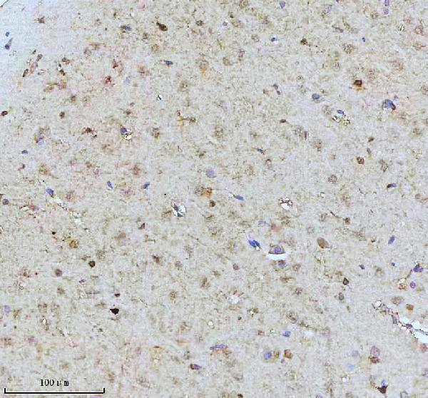 m00229s939 p tuberin primary antibodies ihc testing 3
