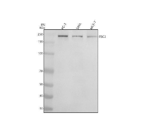 m00229s939 p tuberin primary antibodies wb testing 1_1