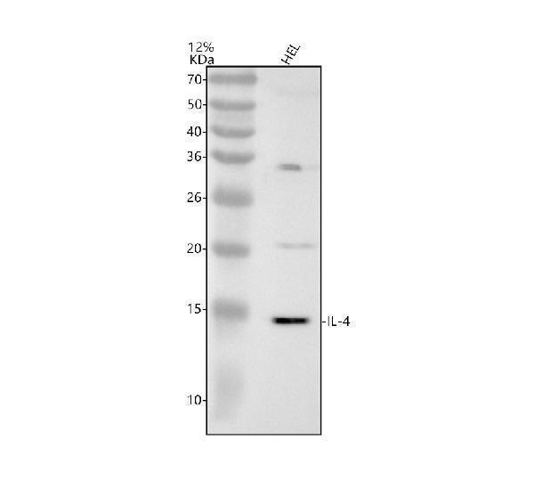 Western blot analysis of IL-4 using anti-IL-4 antibody (M00230)
