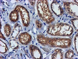 m00231 1 anti fgfr2 mouse monoclonal antibody clone id oti3f8 ihc testing 10