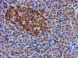m00231 1 anti fgfr2 mouse monoclonal antibody clone id oti3f8 ihc testing 5