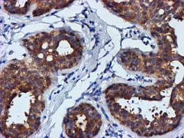 m00231 1 anti fgfr2 mouse monoclonal antibody clone id oti3f8 ihc testing 7