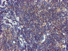 m00231 1 anti fgfr2 mouse monoclonal antibody clone id oti3f8 ihc testing 8