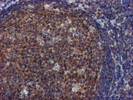 m00231 1 anti fgfr2 mouse monoclonal antibody clone id oti3f8 ihc testing 9