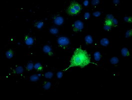 m00231 2 anti fgfr2 mouse monoclonal antibody clone id oti5c5 if testing 11