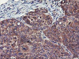 m00231 2 anti fgfr2 mouse monoclonal antibody clone id oti5c5 ihc testing 4