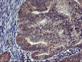 m00231 2 anti fgfr2 mouse monoclonal antibody clone id oti5c5 ihc testing 6