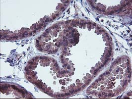 m00231 2 anti fgfr2 mouse monoclonal antibody clone id oti5c5 ihc testing 7