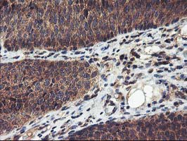 m00231 2 anti fgfr2 mouse monoclonal antibody clone id oti5c5 ihc testing 8