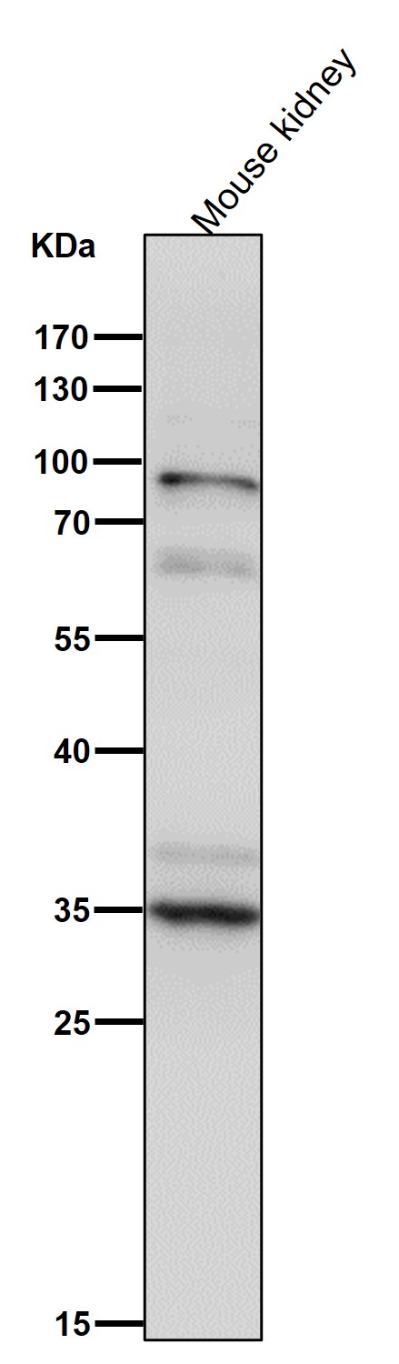 All lanes use the Antibody at 1:1K dilution for 1 hour at room temperature