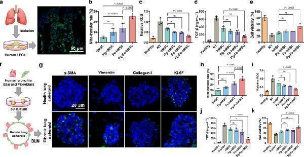 Therapeutic potentials of Pg-Fe-hMSC in both monocellular and multicellular humanized fibrotic models