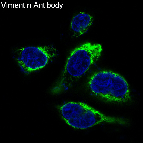m00235 1 vimentin primary antibodies if testing 18