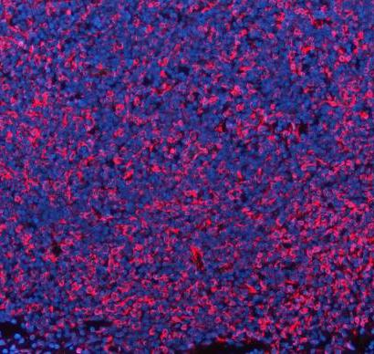 m00235 1 vimentin primary antibodies if testing 19